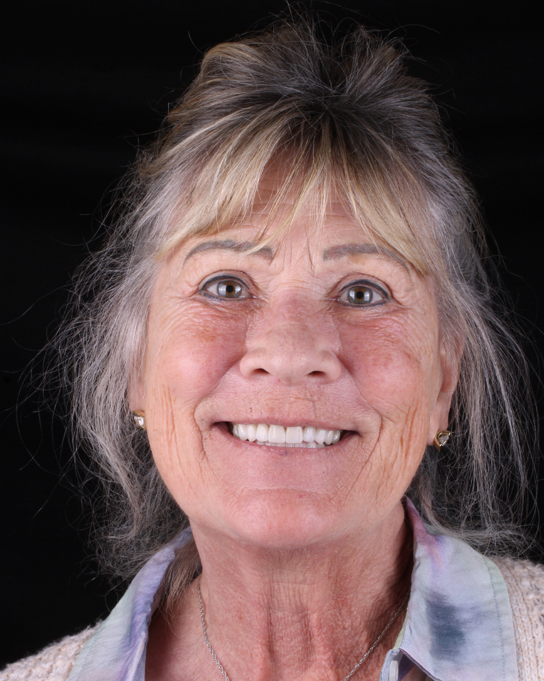 Oral Rehabilitation at LUMA Dental